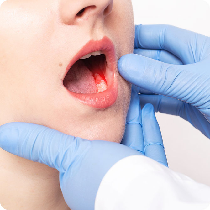 口腔がんは歯科医院で検査することができます