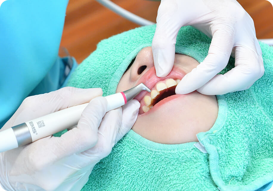 歯科用超音波歯面清掃器によるクリーニング
